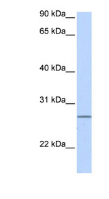 GRPEL2 antibody LS-C102497 Western blot of Fetal Heart lysate.
