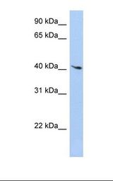 HepG2 cell lysate. Antibody concentration: 1.0 ug/ml. Gel concentration: 12%.