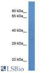 LYL1 antibody Western Blot of HeLa. Antibody dilution: 1 ug/ml.