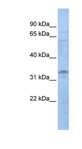 LYL1 antibody LS-C112345 Western blot of 721_B cell lysate.