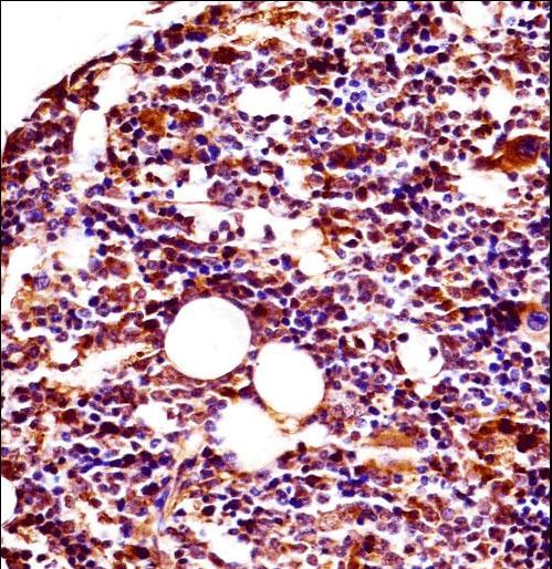 Mouse Lyn Antibody immunohistochemistry of formalin-fixed and paraffin-embedded mouse bone(femur) followed by peroxidase-conjugated secondary antibody and DAB staining.