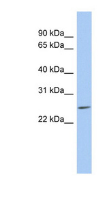 LYPD5 antibody LS-C111717 Western blot of MCF7 cell lysate.