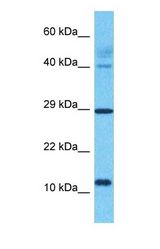 Western blot of LYPD6 Antibody with human Lung Tumor lysate.