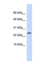 LYPD6 antibody LS-C102542 Western blot of Fetal Small Intestine lysate.