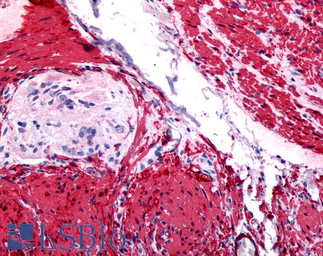 Anti-GRPR antibody LS-A831 IHC of human colon. Immunohistochemistry of formalin-fixed, paraffin-embedded tissue after heat-induced antigen retrieval.