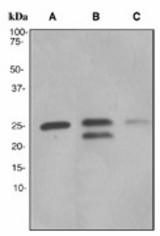 Western blot analysis on (A) fetal liver, (B) fetal heart and (C) human spleen lysates using anti-Acyl protein thioesterase 1 antibody (LS-C105596).