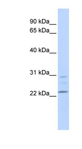 LYPLA1 antibody LS-C111375 Western blot of CCRF-CEM lysate.