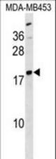 LYPLA1 Antibody western blot of MDA-MB453 cell line lysates (35 ug/lane). The LYPLA1 antibody detected the LYPLA1 protein (arrow).