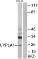 Western blot of extracts from COLO cells, using LYPLA1 Antibody. The lane on the right is treated with the synthesized peptide.