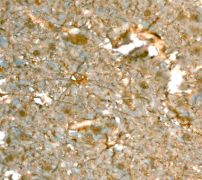 IHC of paraffin-embedded human brain using anti-Acyl protein thioesterase 1 antibody (LS-C105598).