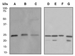 Western blot analysis on (A) fetal liver, (B) fetal heart, (C) human spleen, (D) mouse heart, (E) mouse kidney, (F) mouse spleen and (G) rat kidney lysates using anti-Acyl protein thioesterase 1 antibody (LS-C105598).