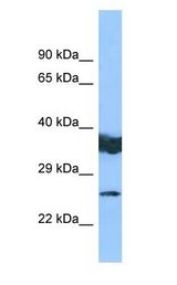 LYPLAL1 antibody Western Blot of COLO205.