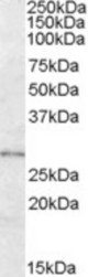 Antibody (0.3 ug/ml) staining of Human Adipose lysate (35 ug protein in RIPA buffer). Primary incubation was 1 hour. Detected by chemiluminescence.