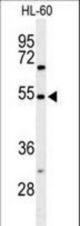Western blot of GRPR Antibody in HL-60 cell line lysates (35 ug/lane). GRPR (arrow) was detected using the purified antibody.