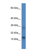 LYRM4 antibody LS-C135444 Western blot of Mouse Liver lysate. Antibody concentration 1 ug/ml.