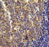 LYRM4 antibody immunohistochemistry of formalin-fixed and paraffin-embedded human tonsil tissue followed by peroxidase-conjugated secondary antibody and DAB staining.