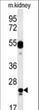LYSMD1 Antibody western blot of mouse kidney tissue lysates (15 ug/lane). The LYSMD1 antibody detected LYSMD1 protein (arrow).