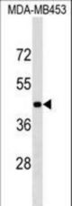 GRSF1 Antibody western blot of MDA-MB453 cell line lysates (35 ug/lane). The GRSF1 antibody detected the GRSF1 protein (arrow).