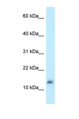 LYZL4 antibody LS-C145965 Western blot of MCF7 Cell lysate. Antibody concentration 1 ug/ml.