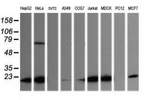 Western blot of extracts (35ug) from 9 different cell lines by using anti-LZIC monoclonal antibody (HepG2: human; HeLa: human; SVT2: mouse; A549: human; COS7: monkey; Jurkat: human; MDCK: canine; PC12: rat; MCF7: human).