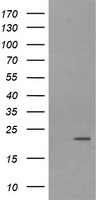 HEK293T cells were transfected with the pCMV6-ENTRY control (Left lane) or pCMV6-ENTRY LZIC (Right lane) cDNA for 48 hrs and lysed. Equivalent amounts of cell lysates (5 ug per lane) were separated by SDS-PAGE and immunoblotted with anti-LZIC.