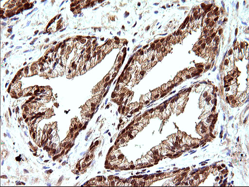 IHC of paraffin-embedded Human prostate tissue using anti-LZIC mouse monoclonal antibody. (Heat-induced epitope retrieval by 10mM citric buffer, pH6.0, 120°C for 3min).