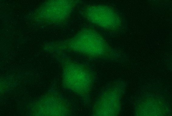 Immunofluorescent staining of HeLa cells using anti-LZIC mouse monoclonal antibody.