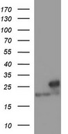 HEK293T cells were transfected with the pCMV6-ENTRY control (Left lane) or pCMV6-ENTRY LZIC (Right lane) cDNA for 48 hrs and lysed. Equivalent amounts of cell lysates (5 ug per lane) were separated by SDS-PAGE and immunoblotted with anti-LZIC.