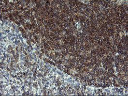 IHC of paraffin-embedded Human lymph node tissue using anti-LZIC mouse monoclonal antibody. (Heat-induced epitope retrieval by 10mM citric buffer, pH6.0, 120°C for 3min).