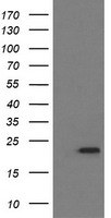 HEK293T cells were transfected with the pCMV6-ENTRY control (Left lane) or pCMV6-ENTRY LZIC (Right lane) cDNA for 48 hrs and lysed. Equivalent amounts of cell lysates (5 ug per lane) were separated by SDS-PAGE and immunoblotted with anti-LZIC.