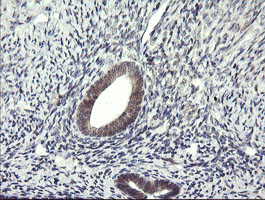IHC of paraffin-embedded Human endometrium tissue using anti-LZIC mouse monoclonal antibody. (Heat-induced epitope retrieval by 10mM citric buffer, pH6.0, 120°C for 3min).