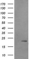 HEK293T cells were transfected with the pCMV6-ENTRY control (Left lane) or pCMV6-ENTRY LZIC (Right lane) cDNA for 48 hrs and lysed. Equivalent amounts of cell lysates (5 ug per lane) were separated by SDS-PAGE and immunoblotted with anti-LZIC.
