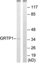 Western blot of extracts from 293 cells, using GRTP1 Antibody. The lane on the right is treated with the synthesized peptide.