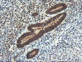 IHC of paraffin-embedded Human endometrium tissue using anti-LZIC mouse monoclonal antibody.