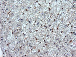 IHC of paraffin-embedded Human liver tissue using anti-LZIC mouse monoclonal antibody.