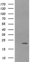 HEK293T cells were transfected with the pCMV6-ENTRY control (Left lane) or pCMV6-ENTRY LZIC (Right lane) cDNA for 48 hrs and lysed. Equivalent amounts of cell lysates (5 ug per lane) were separated by SDS-PAGE and immunoblotted with anti-LZIC.