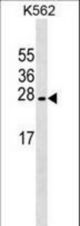 LZIC Antibody western blot of K562 cell line lysates (35 ug/lane). The LZIC antibody detected the LZIC protein (arrow).