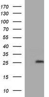 HEK293T cells were transfected with the pCMV6-ENTRY control (Left lane) or pCMV6-ENTRY LZIC (Right lane) cDNA for 48 hrs and lysed. Equivalent amounts of cell lysates (5 ug per lane) were separated by SDS-PAGE and immunoblotted with anti-LZIC.