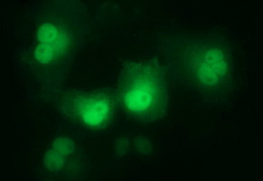 Anti-LZIC mouse monoclonal antibody immunofluorescent staining of COS7 cells transiently transfected by pCMV6-ENTRY LZIC.