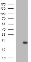 HEK293T cells were transfected with the pCMV6-ENTRY control (Left lane) or pCMV6-ENTRY LZIC (Right lane) cDNA for 48 hrs and lysed. Equivalent amounts of cell lysates (5 ug per lane) were separated by SDS-PAGE and immunoblotted with anti-LZIC.
