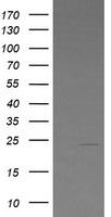 HEK293T cells were transfected with the pCMV6-ENTRY control (Left lane) or pCMV6-ENTRY LZIC (Right lane) cDNA for 48 hrs and lysed. Equivalent amounts of cell lysates (5 ug per lane) were separated by SDS-PAGE and immunoblotted with anti-LZIC.