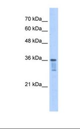 Jurkat cell lysate. Antibody concentration: 2.5 ug/ml. Gel concentration: 12%.