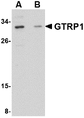 Western blot of GRTP1 in SK-N-SH cell lysate with GRTP1 antibody at 1 ug/ml in the (A) absence and (B) presence of blocking peptide.