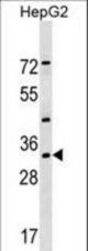 LZTFL1 Antibody western blot of HepG2 cell line lysates (35 ug/lane). The LZTFL1 antibody detected the LZTFL1 protein (arrow).