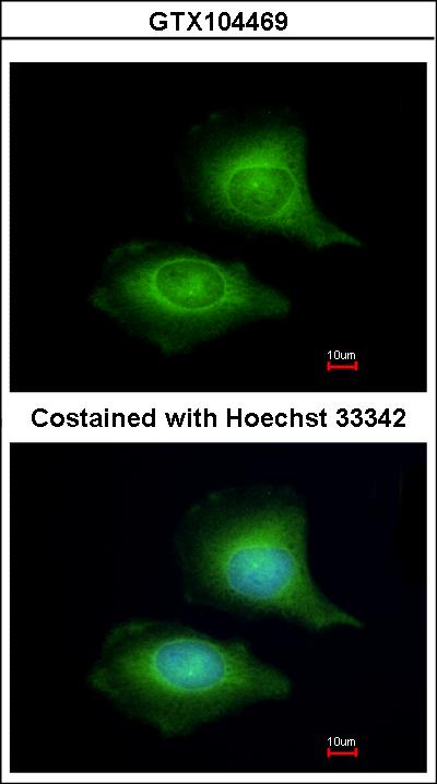 Immunofluorescence of methanol-fixed HeLa using LZTFL1 antibody at 1:200 dilution.