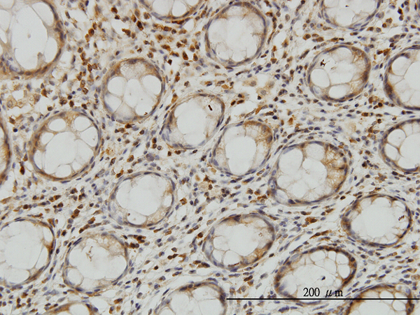 Immunoperoxidase of monoclonal antibody to LZTFL1 on formalin-fixed paraffin-embedded human colon. [antibody concentration 3 ug/ml]