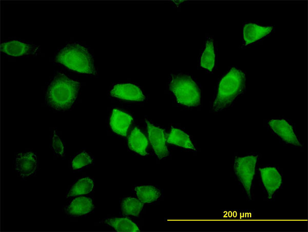 Immunofluorescence of monoclonal antibody to LZTFL1 on HeLa cell. [antibody concentration 25 ug/ml]
