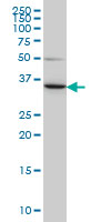 LZTFL1 monoclonal antibody (M01), clone 7F6 Western blot of LZTFL1 expression in HeLa.