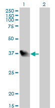 Western blot of LZTFL1 expression in transfected 293T cell line by LZTFL1 monoclonal antibody (M01), clone 7F6.