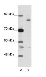 A: Marker, B: Jurkat Cell Lysate